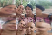 A paciente aguarda cirurgia para retirada de nódulo na mama