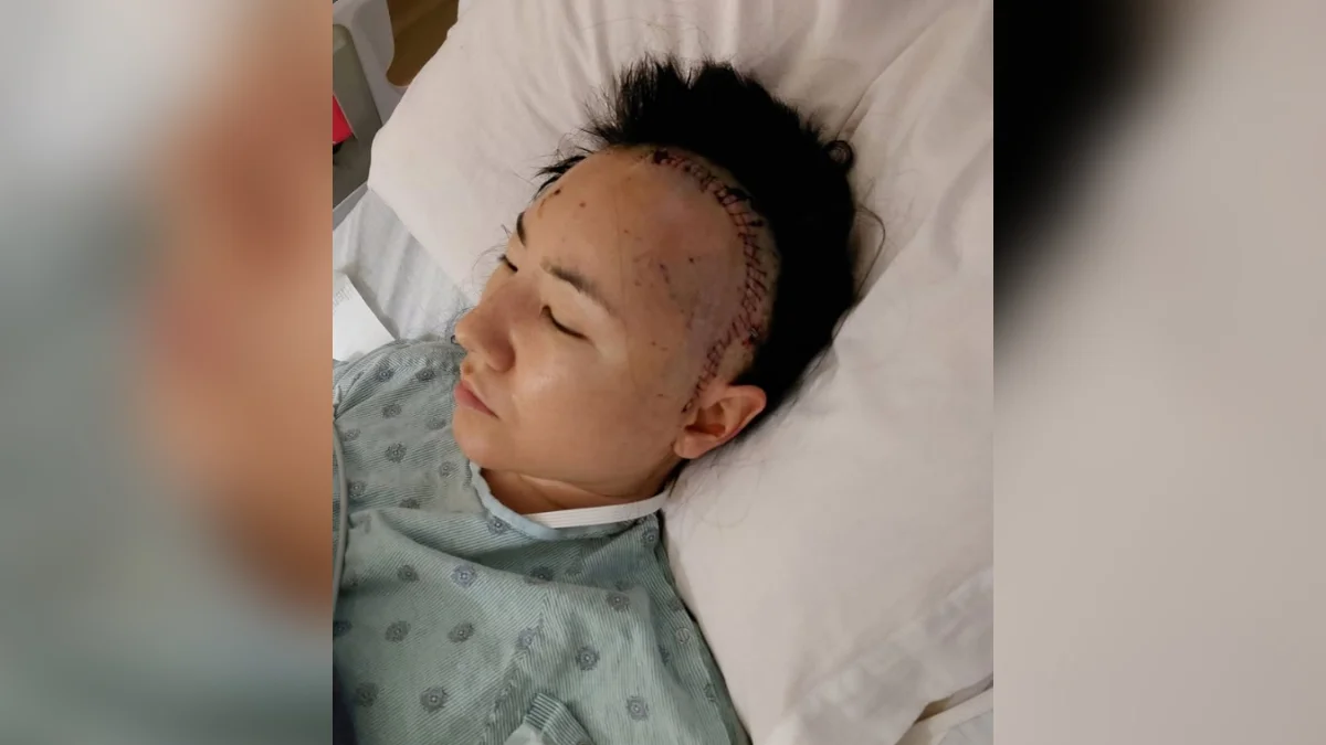 Grávida de 35 semanas, mulher sofre AVC e descobre doença cerebral rara