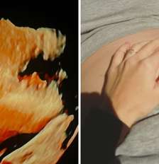 Imagem da matéria: Marco Luque comenta gravidez da esposa após reversão da vasectomia: 'Não sabia que seria rápido'